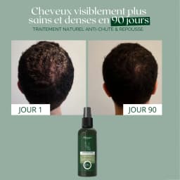 Natural Anti-Hair Loss & Regrowth Lotion – 3% Baicapil + Rosemary – 90-Day Treatment