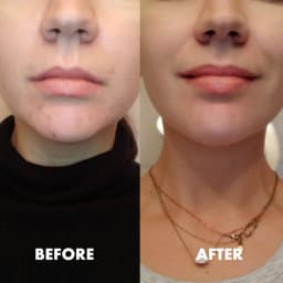 Vitamin E Hybrid Serum