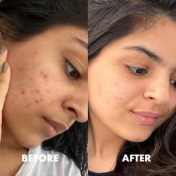 Vitamin E Hybrid Serum