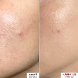 Centella SOS Patch – Invisible 'Patch-Like' Spot Gel